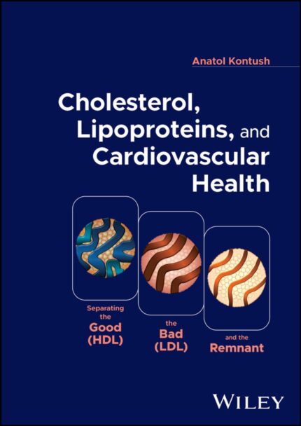 Cholesterol Lipoproteins and Cardiovascular