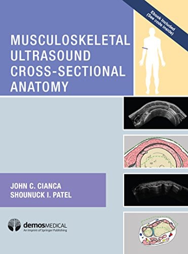 Musculoskeletal Ultrasound Cross-Sectional Anatomy (PDF)