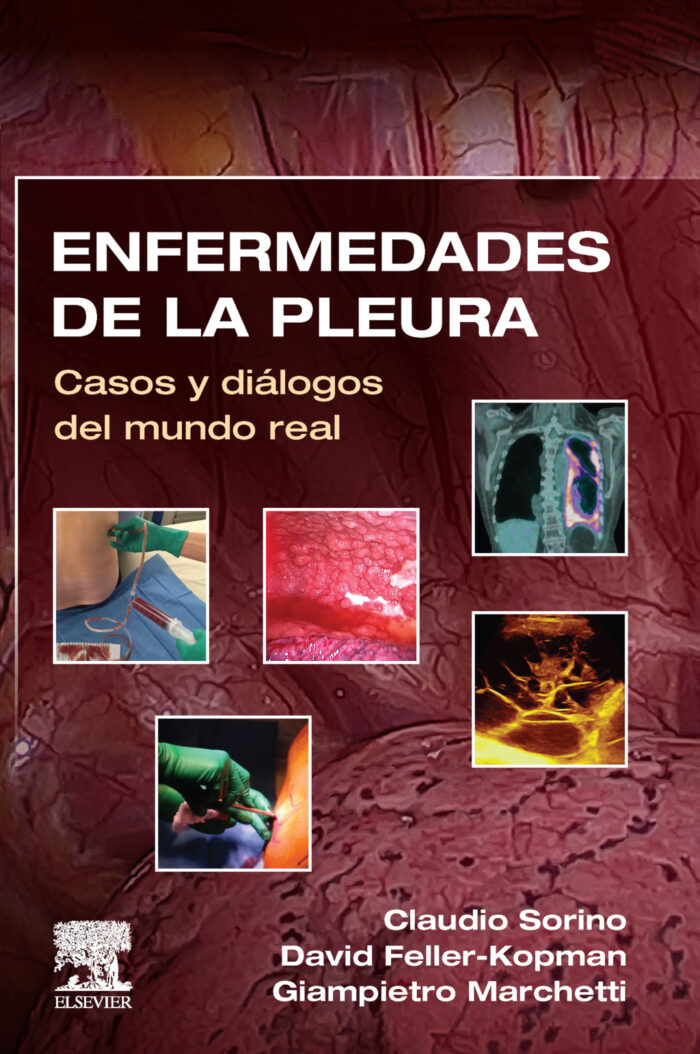 Enfermedades de la pleura Casos y diálogos del mundo real (True PDF)